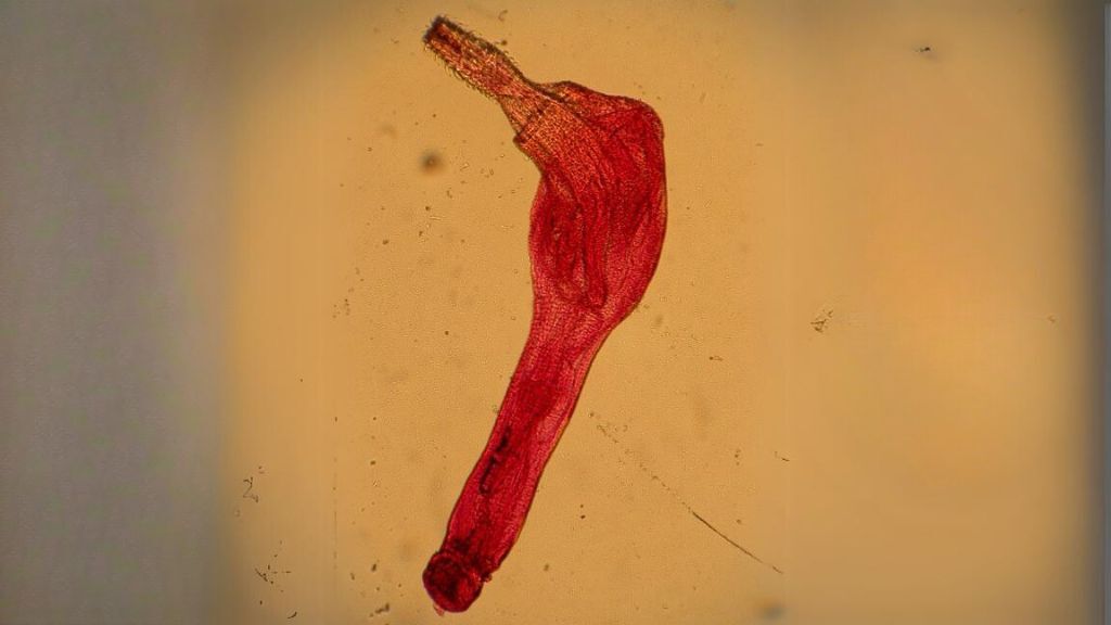 Kolcoglowy-1